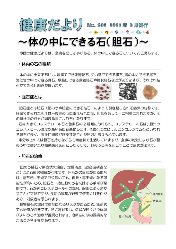 健康だよりNo286 胆石結石 2025年8月発行のサムネイル